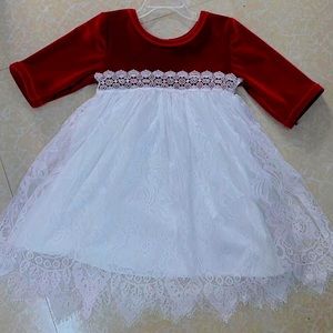 Lever top lace dress